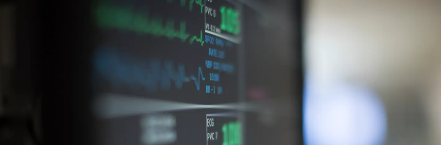 Closeup of a cardio monitor 