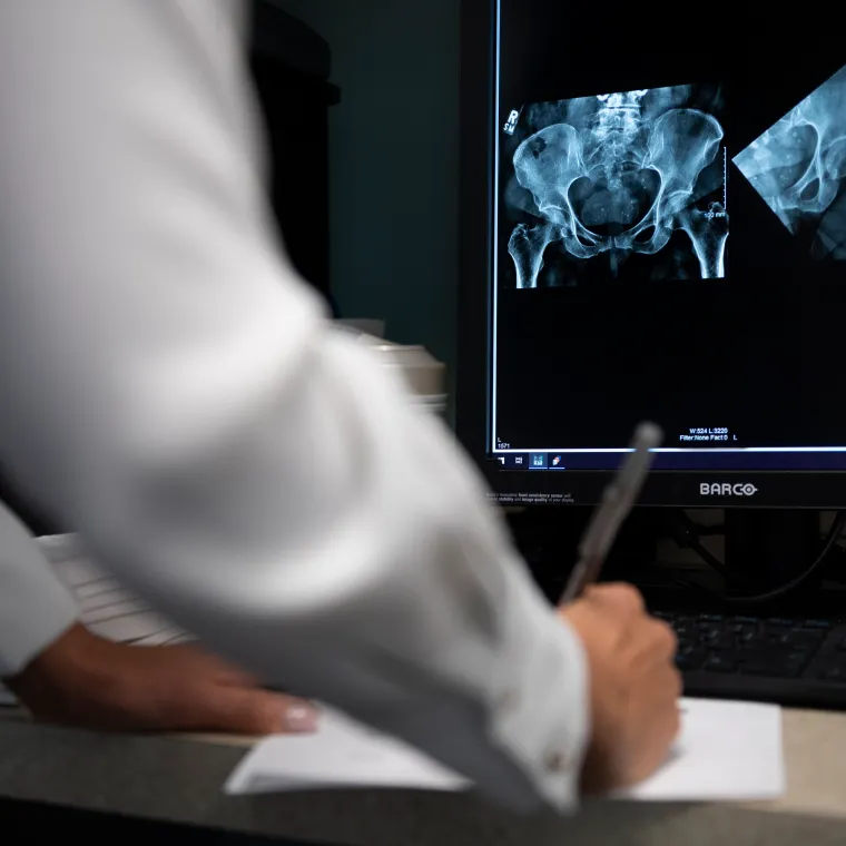 A healthcare provider is writing as they review an x-ray of a patients hip. A healthcare provider is writing as they review an x-ray of a patients hip.